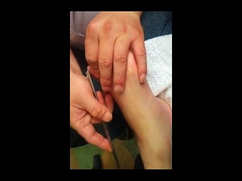 Professional Foot Care (85) Relaxing Nail Pedicure and Treatment of Foot Diseases