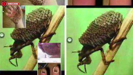 TRYPOPHOBIA ALERT! Killer Insect Destroys Hand; Is It Real?
