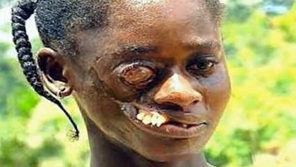 10 Diseases That Kill You in 24 Hours