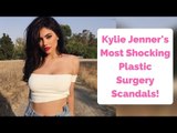 Kylie Jenner's Top 5 Most Shocking Plastic Surgery Scandals Revealed!