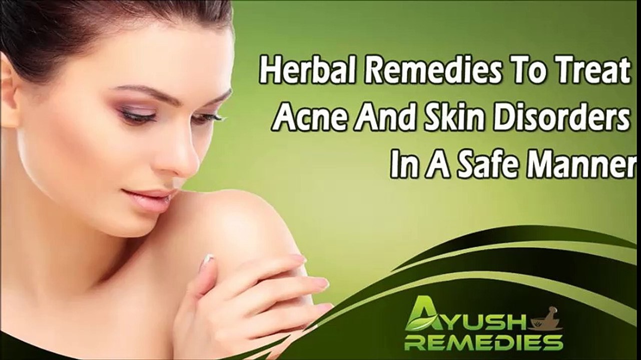 Herbal Remedies To Treat Acne And Skin Disorders In A Safe Manner