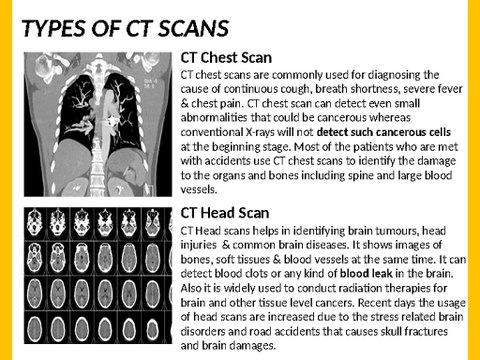CT Scans in Bangalore -Just Rs.1999 /