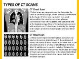 CT Scans in Bangalore -Just Rs.1999 /