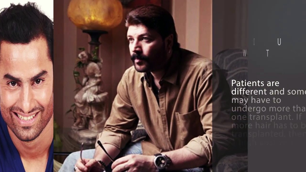 Most Important Questions Before Hair Transplant Surgery