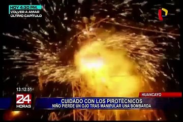 Huancayo: niño de 13 años perdió un ojo tras explosión de bombarda