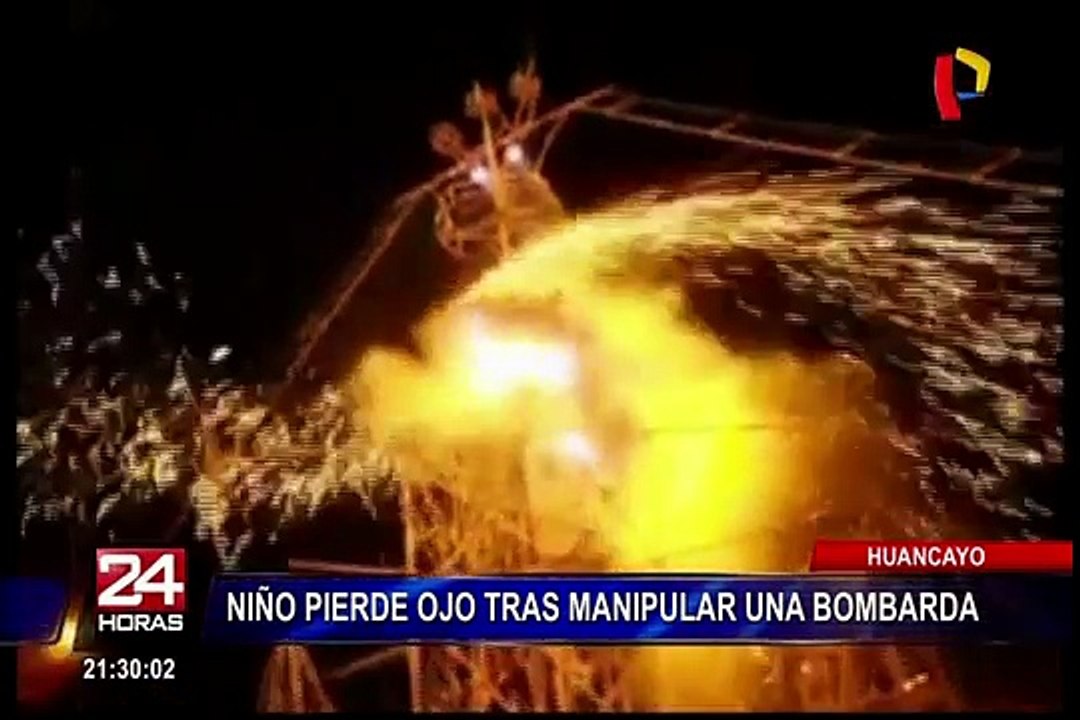 Huancayo: niño de 13 años perdió un ojo tras explosión de bombarda