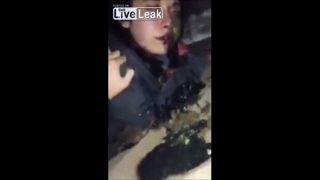 Vous n'avez jamais vu quelqu'un vomir une substance aussi écoeurante