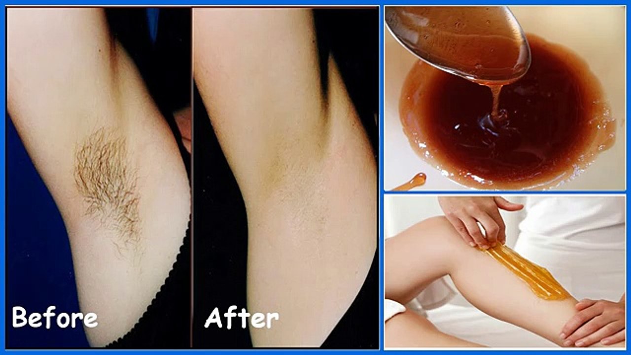 How to Remove  Armpit Hair Permanently Body Hair Removal