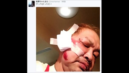（1/2）【ウナちゃんマン】飲み屋で口論になった若い男2人に背後から襲撃されボコボコに殴られ大ケガ