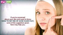 Tips How to Get Rid of Acne Scars Fast 2014