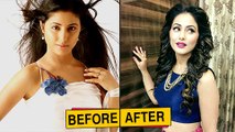 Top TV Actresses Before And After PLASTIC Surgery  Mouni Roy, Hina Khan and Others