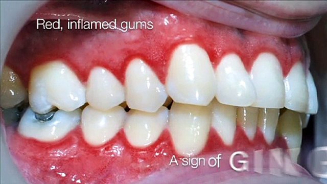 In Office Cleaning | Phan-tastic Smiles