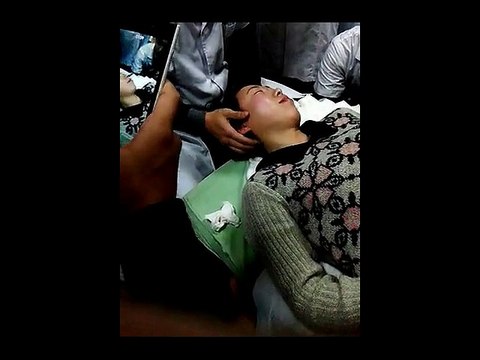 Chinese Chiropractic Adjustment (52) Treatment of Neck Pain and Spinal Problems