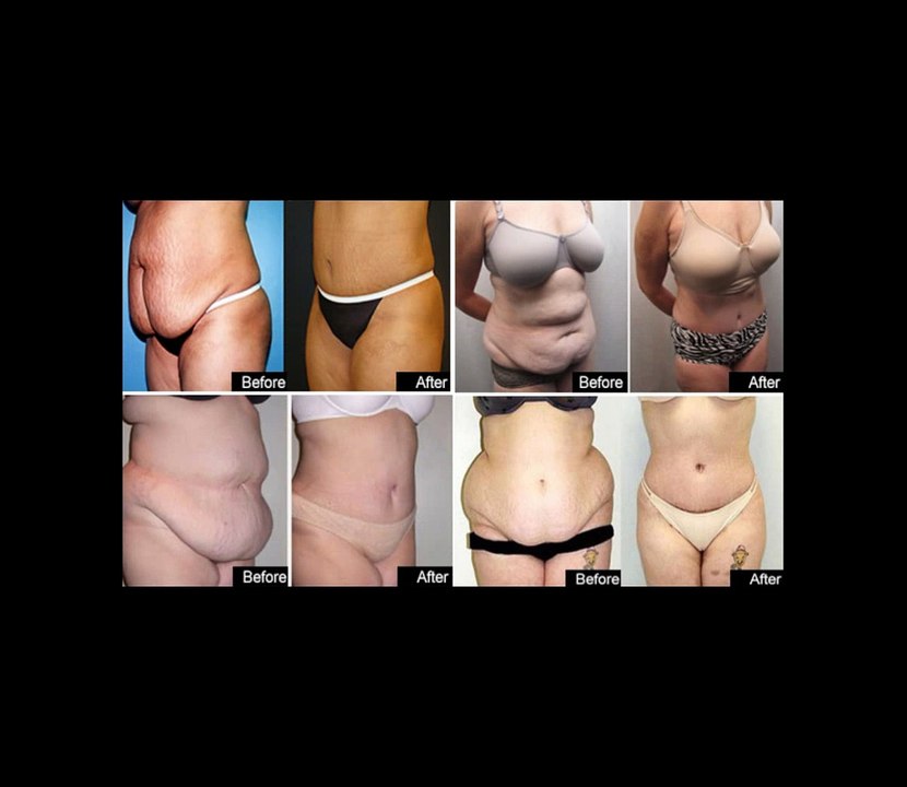 Skinny Vitamins & Supplements - Fast & east weight loss Suppy