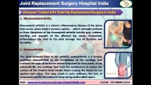 Total Hip Replacement Surgery in India - A New Route for a New Hip