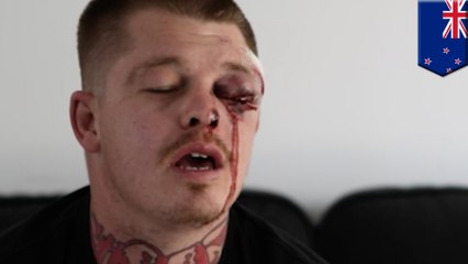 술에 취한 남성, 총 잡고 있던 남성 비웃다, 눈에 총 맞아, 피 철철