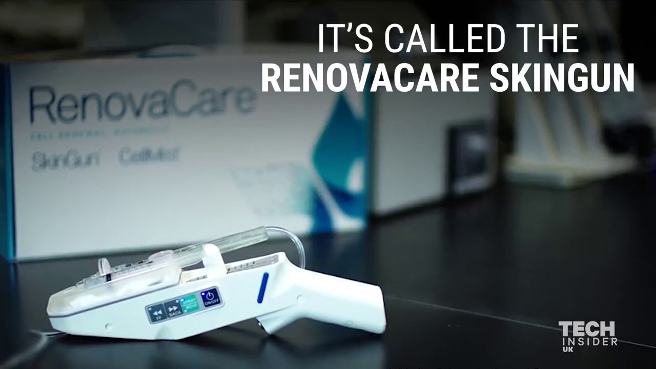 This gun sprays stem cells on burn victims to regrow skin without scars.