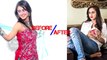Top TV Actresses Before And After PLASTIC Surgery | Mouni Roy, Hina Khan and Others