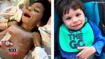 Starving 8-Year-Old Orphan Who Weighed Only 8 Lbs. Now Looks Unrecognizable