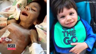 Starving 8-Year-Old Orphan Who Weighed Only 8 Lbs. Now Looks Unrecognizable