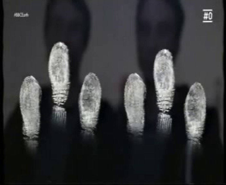 Gemelos identicos: ADN y huellas dactilares distintos