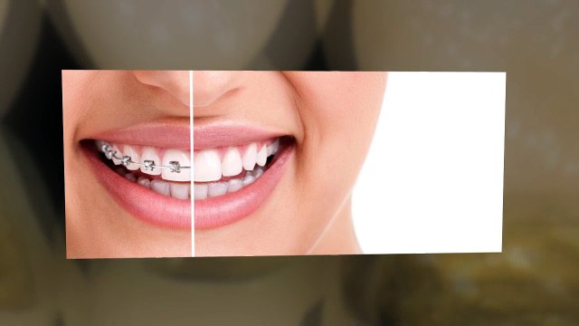 Coral Springs Dental Services - Advanced Dentistry