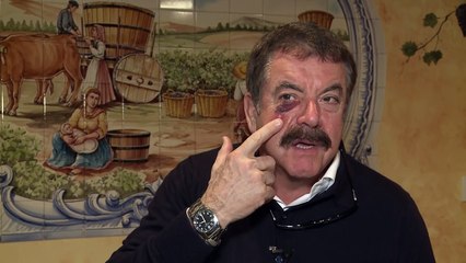 Quim Barreiros explicou com ficou com olho negro