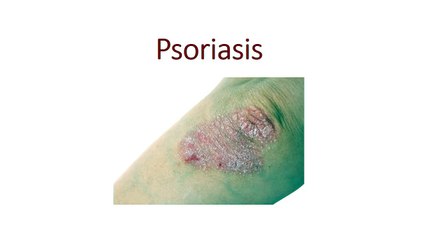 Psoriasis - Everything about it!!