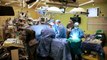 Two-year-old conjoined twins separated by surgeons in US