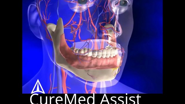 Tooth Anatomy 3D Medical Animation – CureMed Assist – Medical Tourism Company