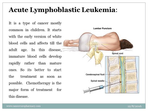Buy - Generic Imatinib Gleevec | Imatinib 400 mg Capsule