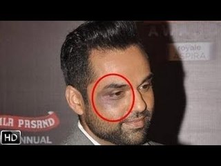 Abhay Deol BEATEN By Music Company! Movie One By Two