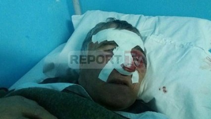 Report TV - Korçë, i qerasi bashkëshorten  polici dhunon qytetarin