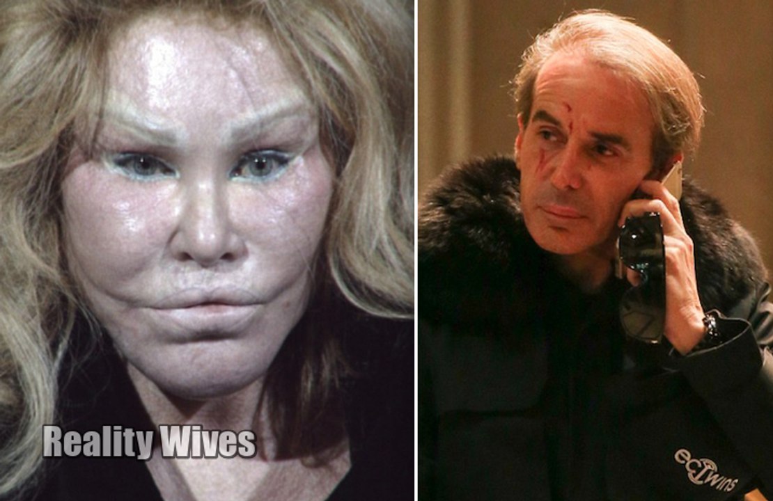 Jocelyn Wildenstein Assaults Boyfriend