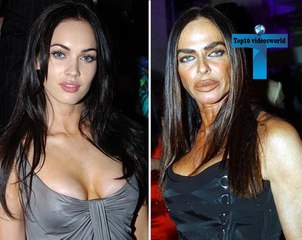 Top 10 Celebrity Plastic Surgery Nightmares