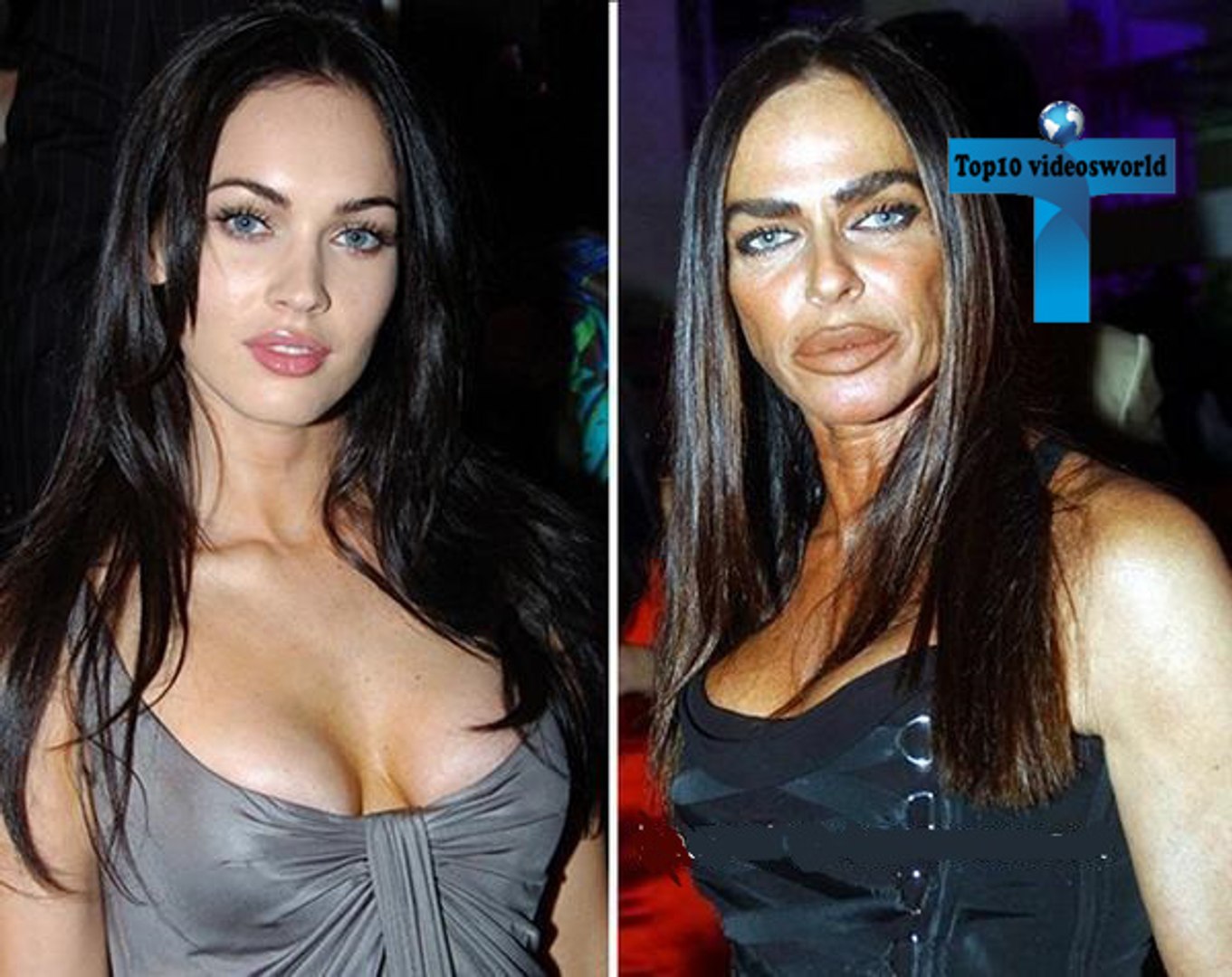 Top 10 Celebrity Plastic Surgery Nightmares