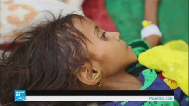 موت طفل يمني كل عشر دقائق بسبب سوء التغذية وانتشار الأمراض