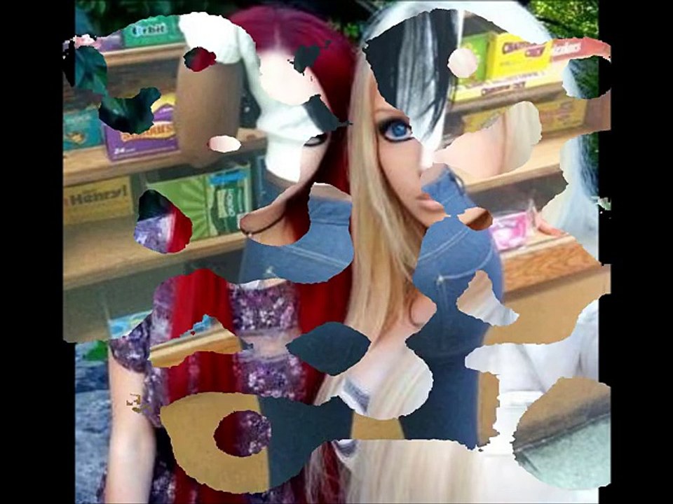 Plastic Surgery Gone Horribly Wrong - Worst Plastic Surgery Ever - Version 1