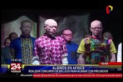 Un concurso de belleza sólo para albinos en Africa