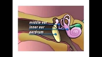 Patient Education Myringotomy Insertion of Tube – CureMed Assist – Medical Tourism Company