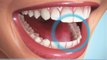 Taches dentaires - Raisons et Solutions Oral-B 3D White