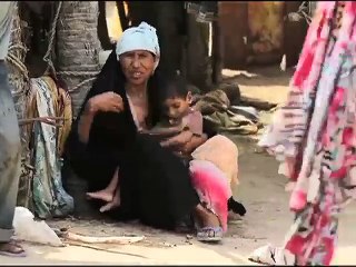 ইয়েমেনে প্রতি ১০ মিনিটে পুষ্টিহীনতায় মারা যাচ্ছে একটি শিশু