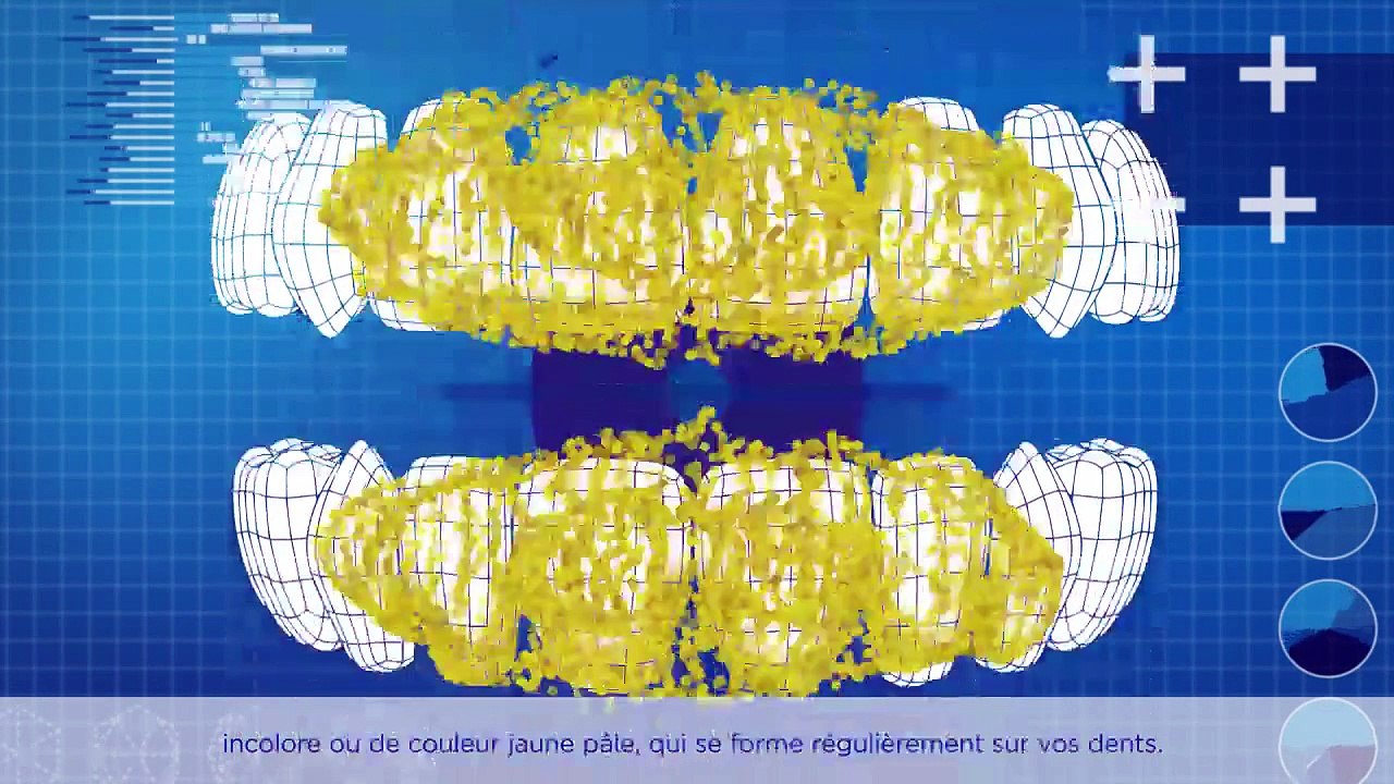 Qu’est-ce que la plaque ?