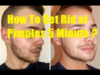 How to get rid of pimples and acne for men
