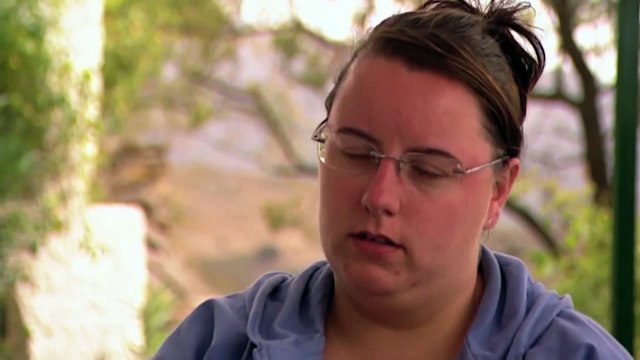 Severe Psoriasis - Spa of Embarrassing Illnesses