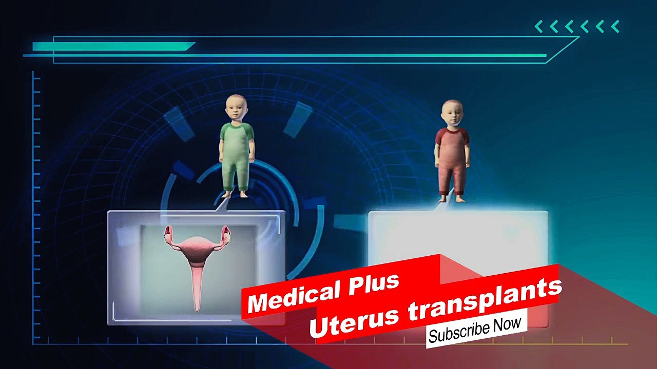 Uterus Transplantaion