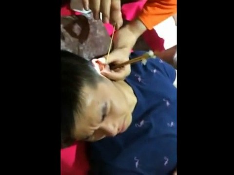 DIY Ear Cleaning (9) Ear Cleaning Relaxation and Stress Relief