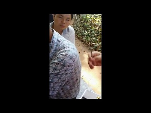 Chinese Ear Cleaning (5) Helping an old man to remove a large piece of ear wax