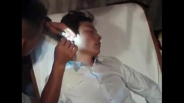 Chinese Ear Cleaning (39) Spa Ear Cleaning Relaxation and Stress Relief