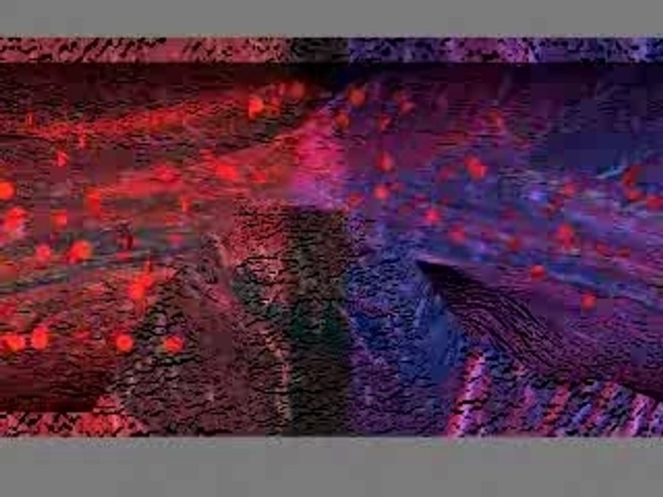 Animation modélisation crise cardiaque / coeur / science